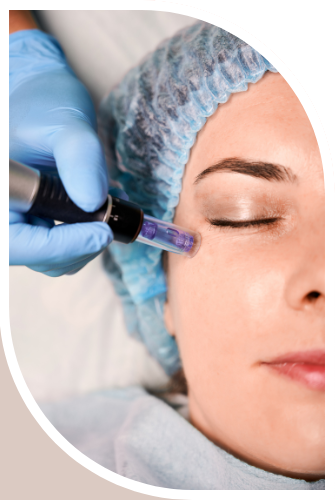 microneedling dermapen